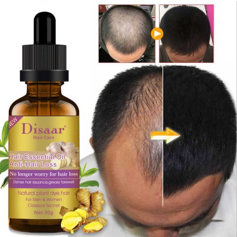 Venda Óleo para tratamento de Calvície e crescimento de cabelo