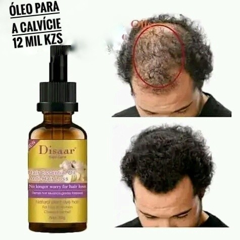 Venda Temos diversidades de produtos para ti