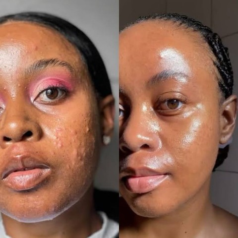 Venda Dr Rashel Nith Fade Spot Cream