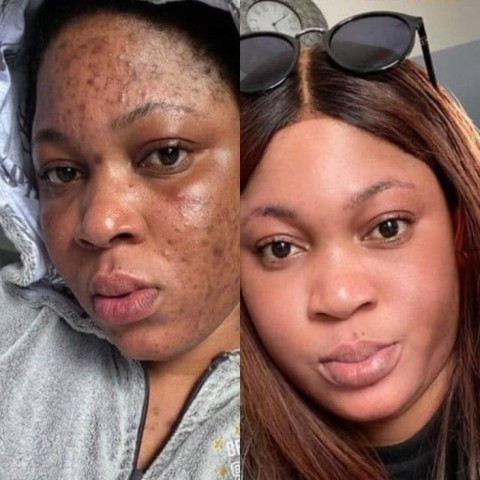 Venda Dr Rashel Nith Fade Spot Cream